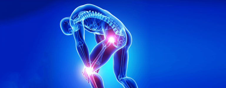 Knee and Hip Disorders